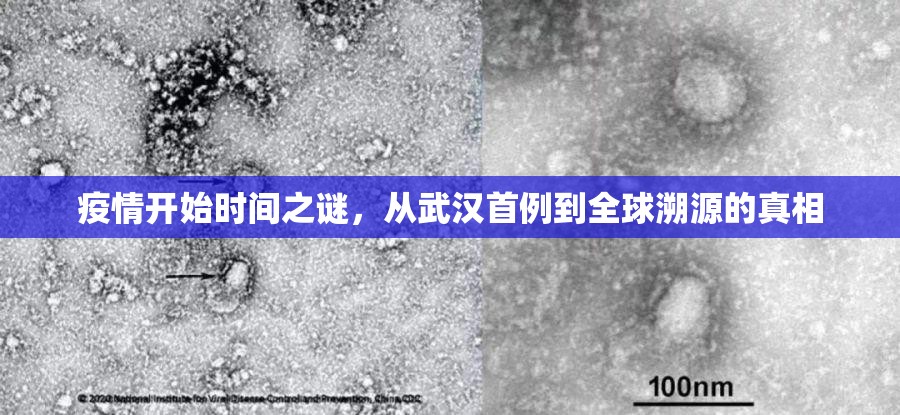 疫情开始时间之谜，从武汉首例到全球溯源的真相