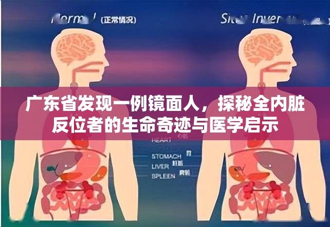 广东省发现一例镜面人，探秘全内脏反位者的生命奇迹与医学启示
