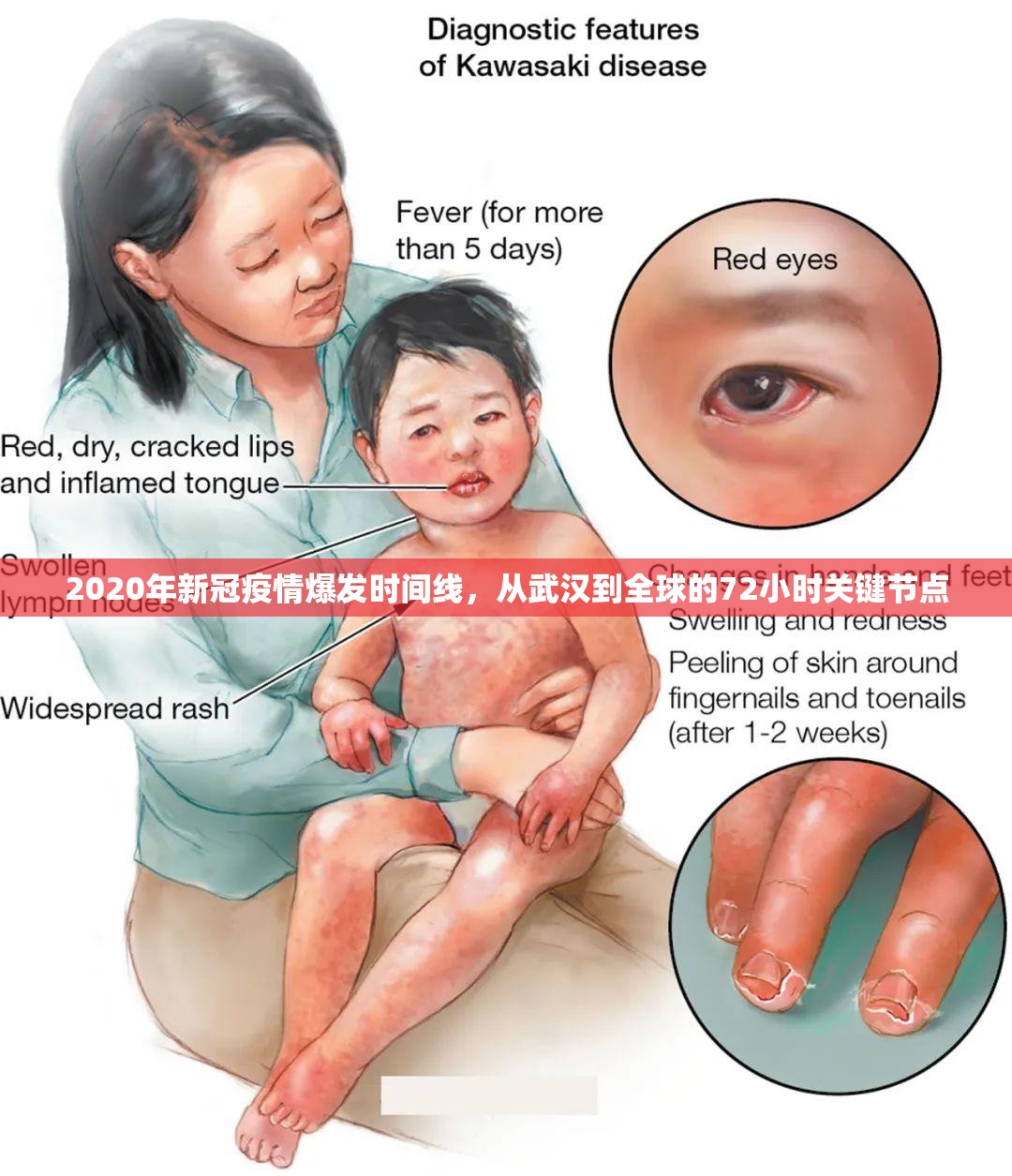 2020年新冠疫情爆发时间线，从武汉到全球的72小时关键节点